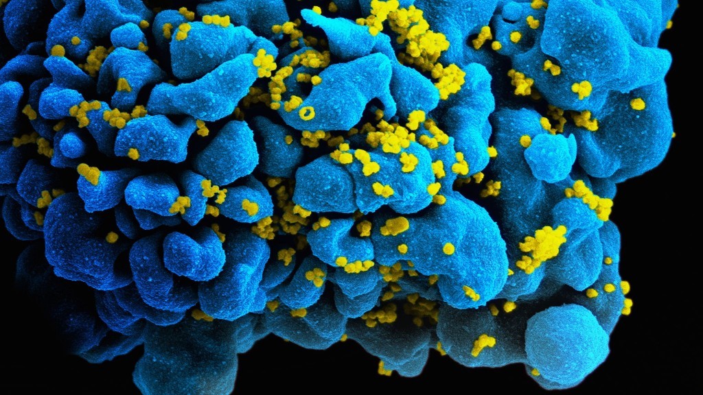 HIV_H9_T-cell-1024x576